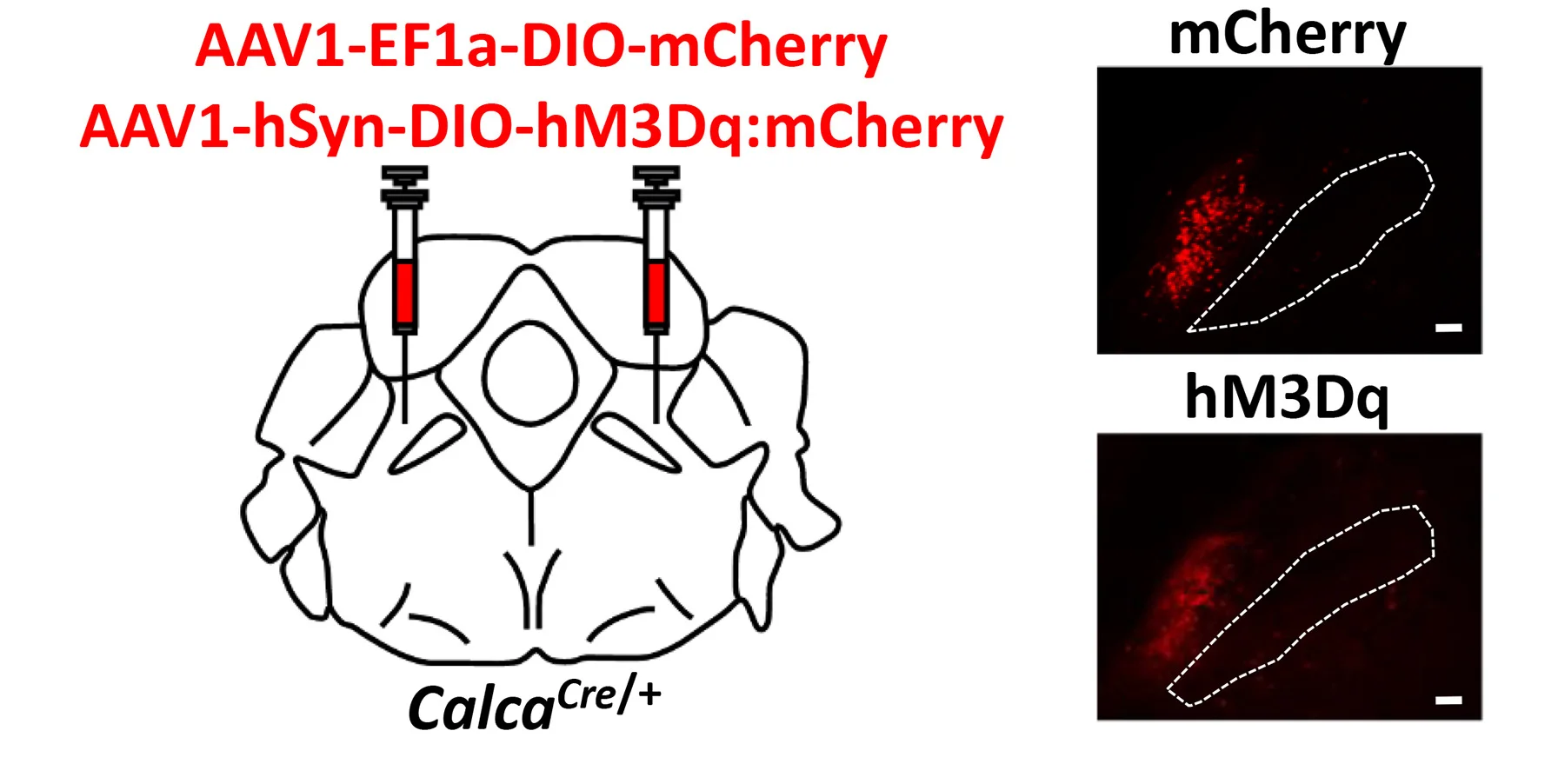 Open access visualization of Microscopy, Illustration, AAV1-Ef1a-DIO-mCherry, AAV1-hSyn-DIO-hM3Dq:mCherry, PBN