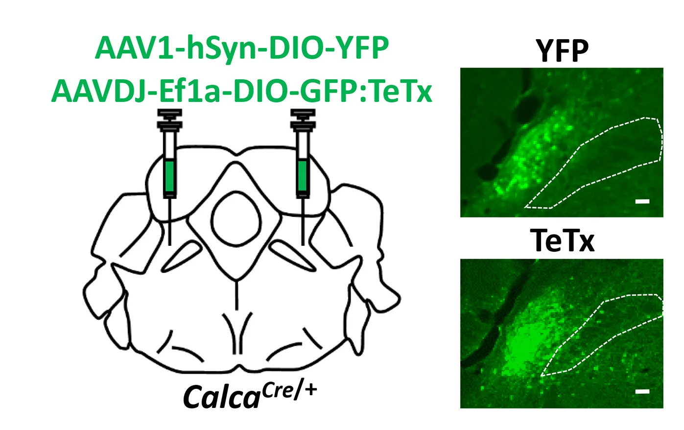 Open access visualization of Microscopy, Illustration, AAV1-hSYN-DIO-YFP, AAVDJ-Ef1a-DIO-GFP:TeTx, PBN