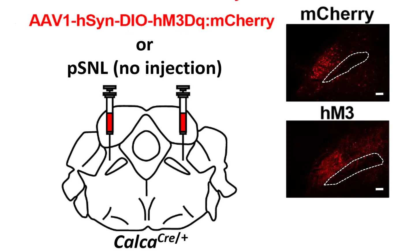 Open access visualization of Microscopy, Illustration, pSNL, AAV1-Ef1a-DIO-mCherry, AAV1-hSyn-DIO-hM3Dq:mCherry