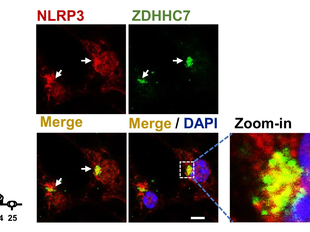 Open access visualization of Microscopy, Confocal Images, NLRP3, ZDHHC7, LPS-primed BMDMs