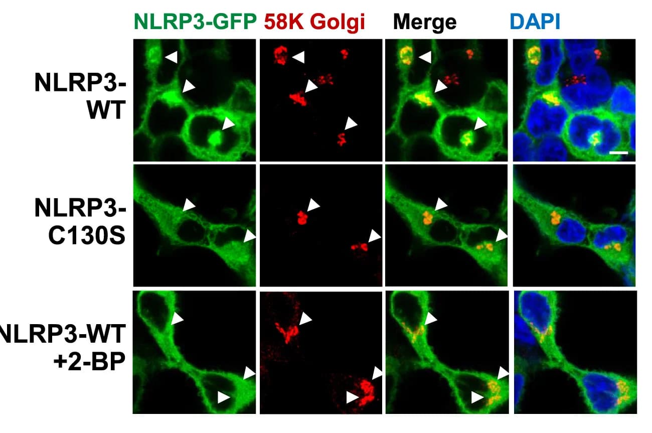 Open access visualization of Microscopy, Confocal Images, GFP-tagged NLRP3, HEK293T Cells, DMSO