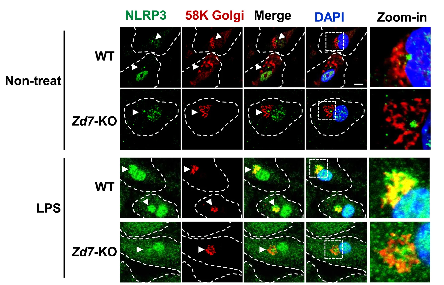Open access visualization of Microscopy, Confocal Images, Endogenous NLRP3, BMDMs, TGN