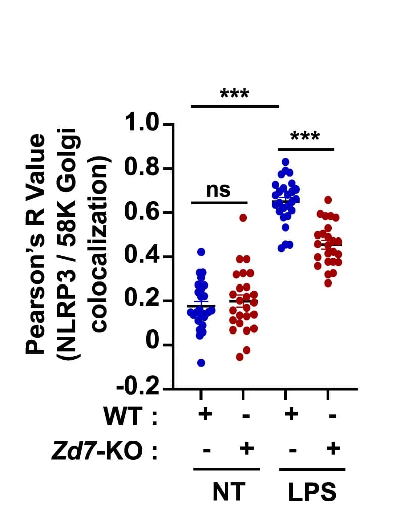 Open access visualization of Scatter Plot, Image Quantification, Pearson's Correlation Coefficient, SEM, Student's t-test