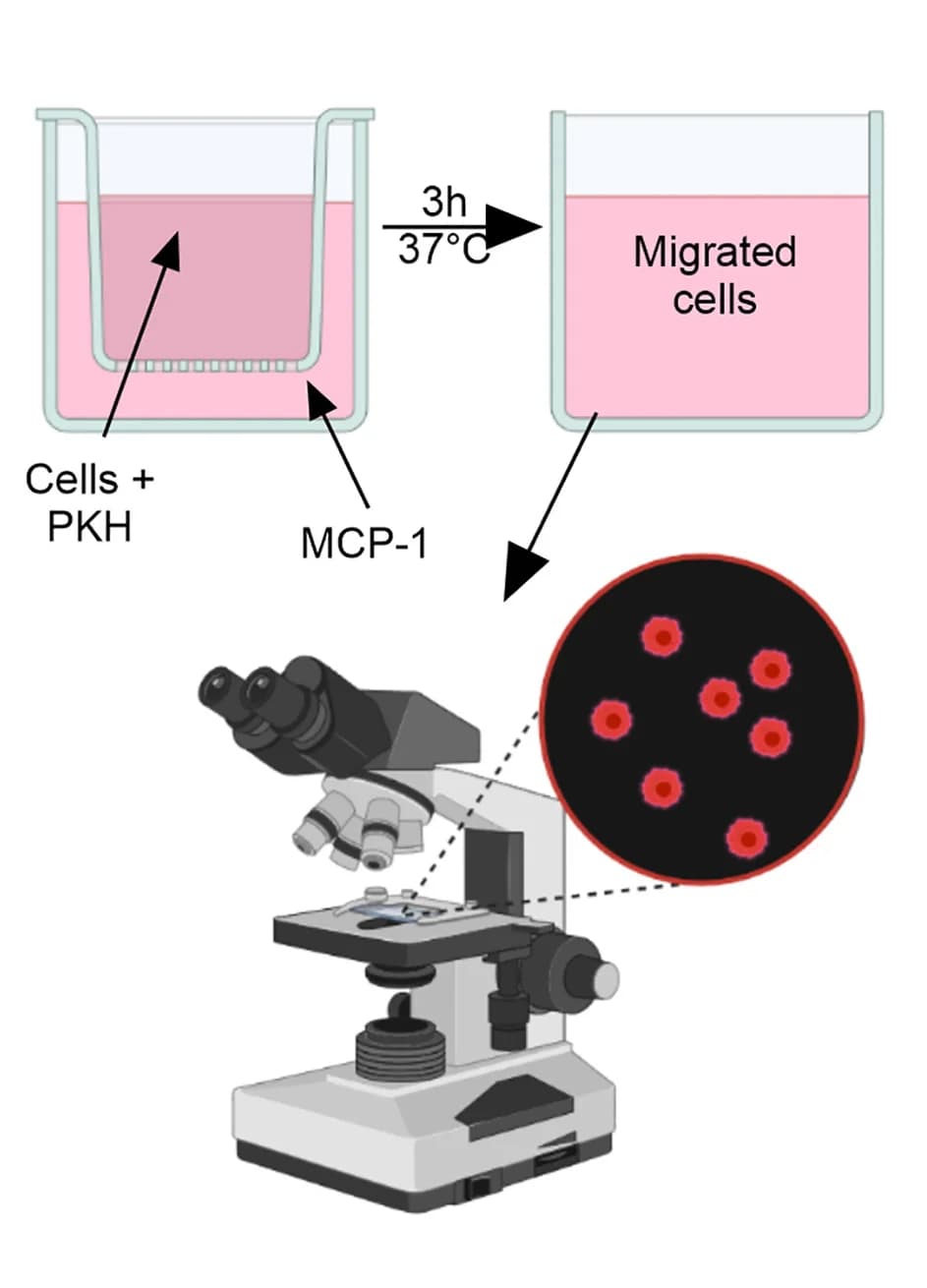 Open access visualization of Workflow, Microscopy, Migration Assay