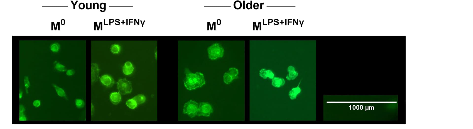 Open access visualization of Microscopy, MDMs, Phalloidin, Scale Bar