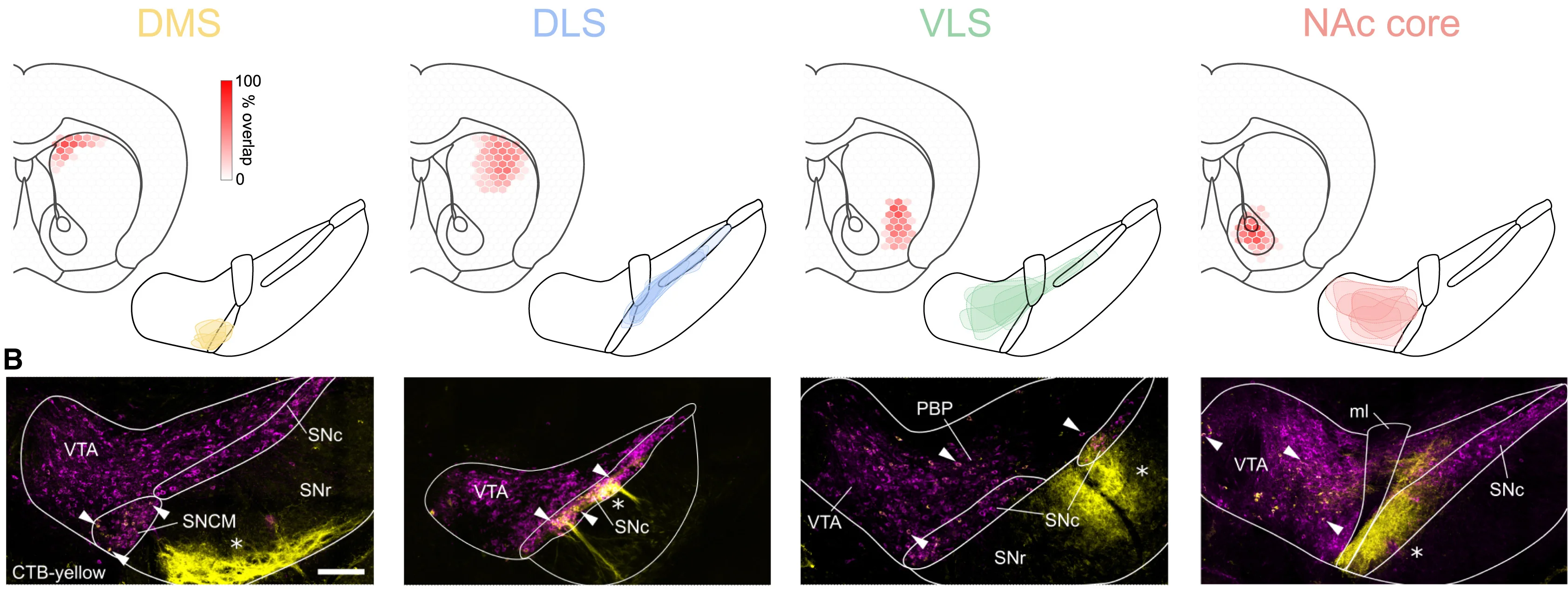 Open access visualization of Microscopy, Map, Retrograde Tracer, Striatal Regions, DMS
