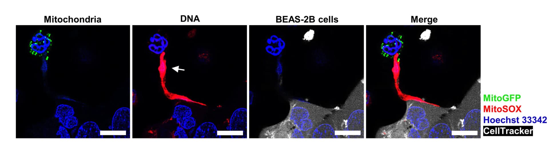 Open access visualization of Microscopy, Eosinophils, BEAS-2B Cells, MitoGFP, Hoechst 33342