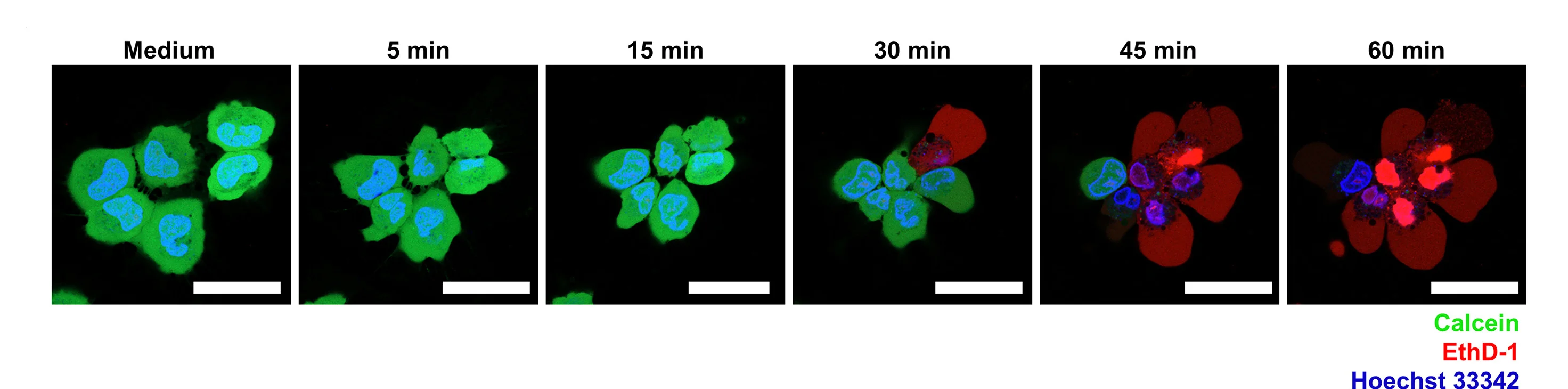 Open access visualization of Microscopy, BEAS-2B Cells, MBP-118-45, Hoechst 33342, Calcein AM