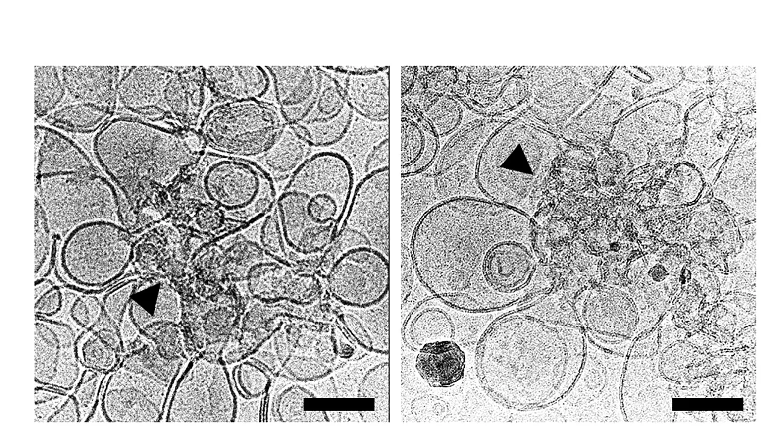 Open access visualization of Microscopy, Liposomes, MBP-118-45, TEM, Lipid Bilayer