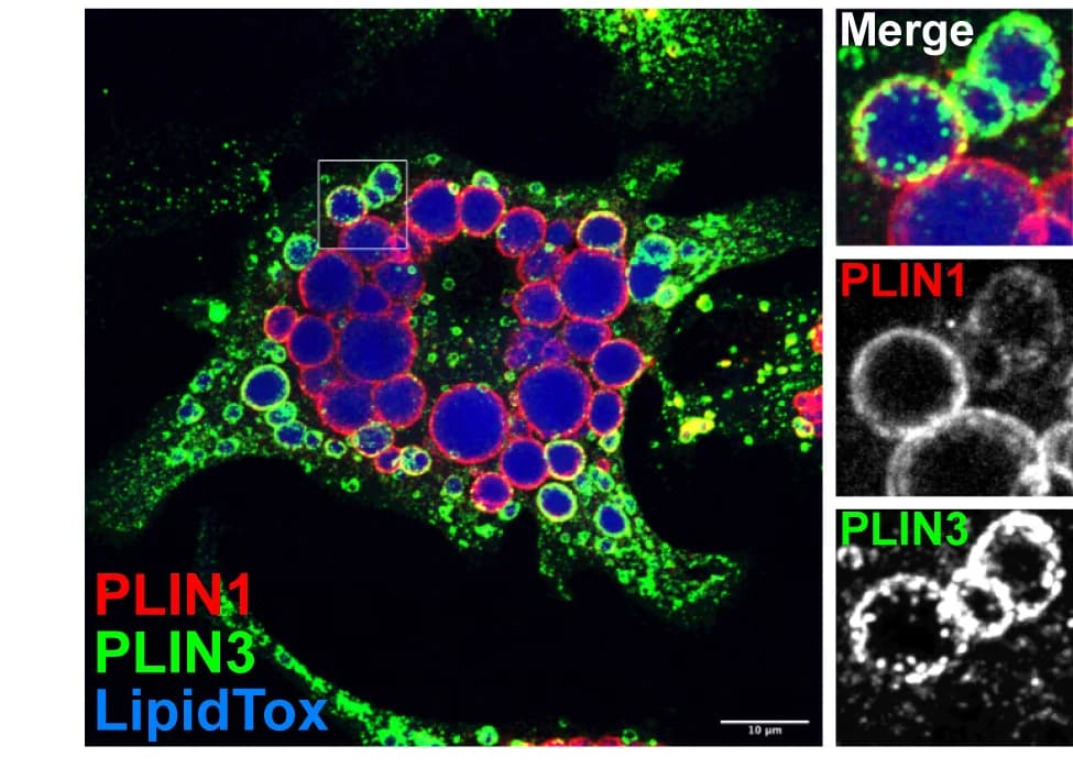 Open access visualization of Microscopy, 3T3-L1 Adipocytes, Na2+oleate, PLIN1, PLIN3