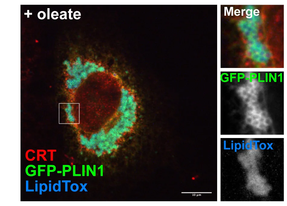 Open access visualization of Microscopy, GFP-Murine PLIN1, COS7 Cells, Endoplasmic Reticulum, Calreticulin