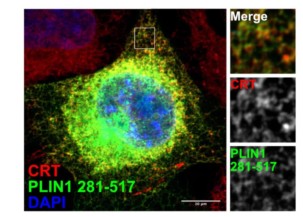 Open access visualization of Microscopy, COS7 Cells, GFP-PLIN1, Endoplasmic Reticulum, CRT Antibody