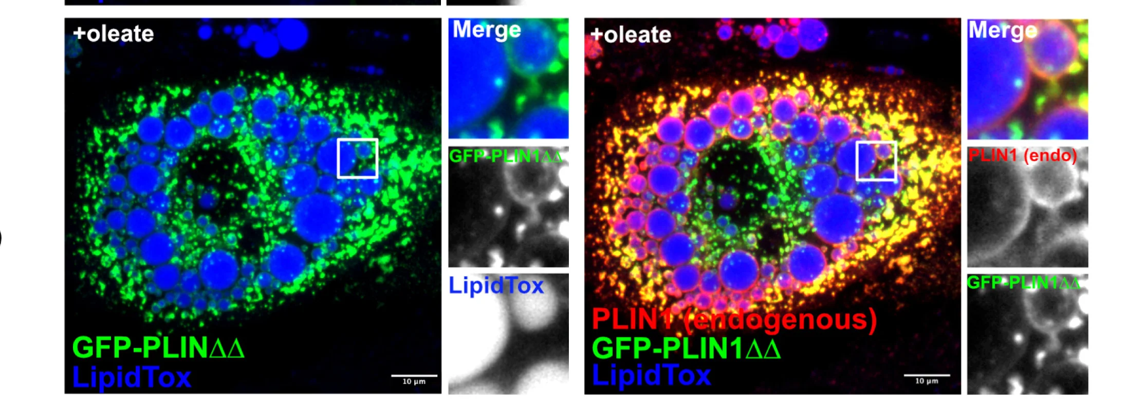 Open access visualization of Microscopy, Oleate, GFP-PLIN1, Peripheral LDs, Endogenous PLIN1