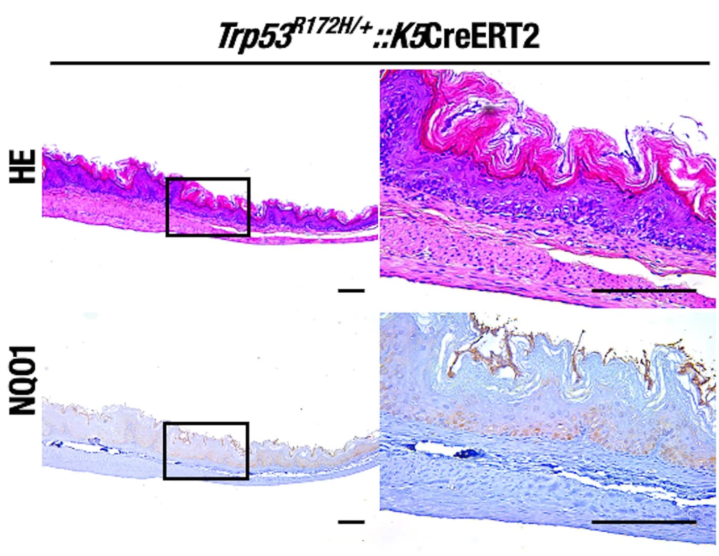 Open access visualization of Microscopy, H&E Staining, NQO1 Immunostaining, Forestomach, Trp53R172H