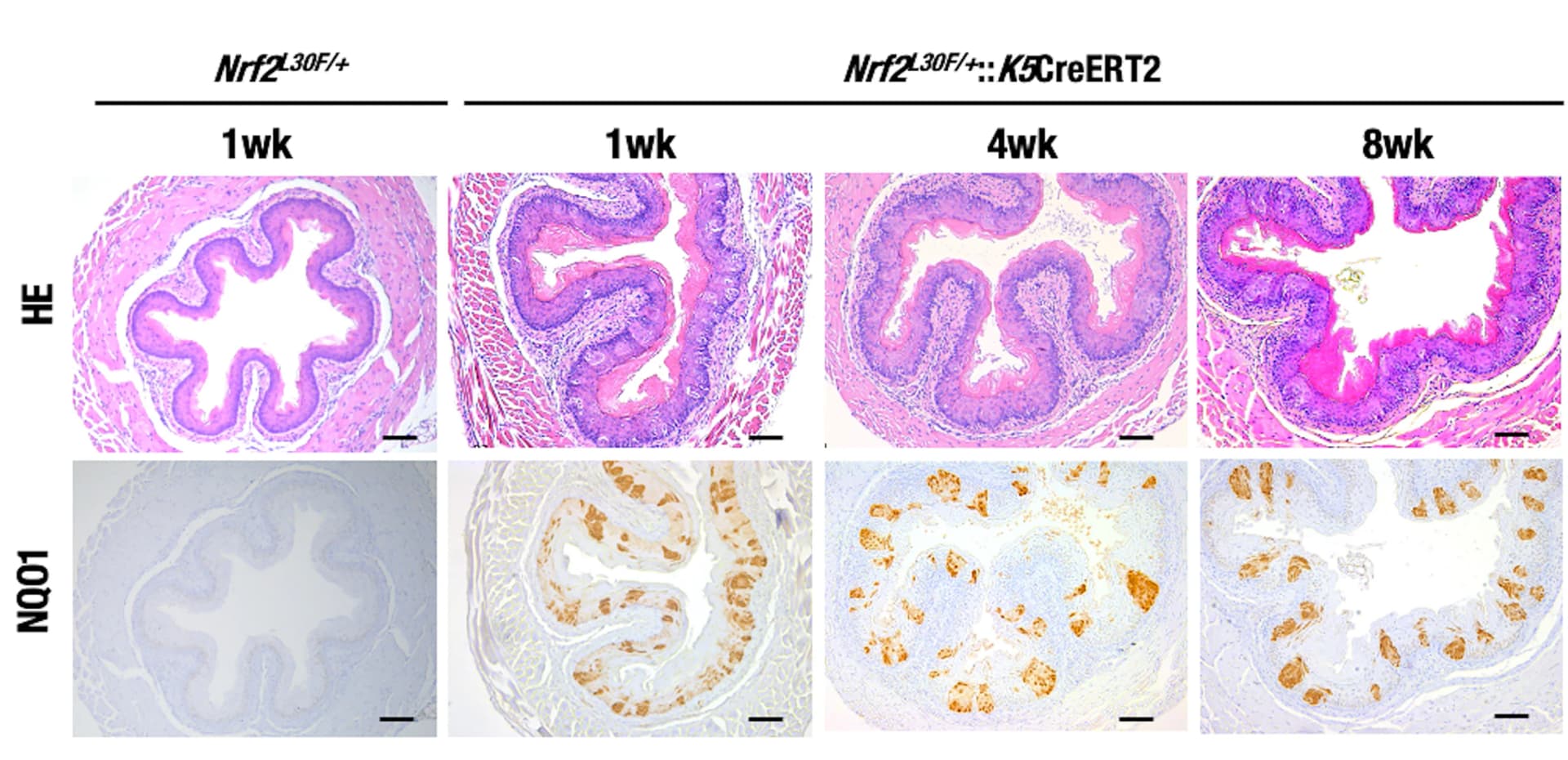 Open access visualization of Microscopy, H&E Staining, NQO1 Immunostaining, Esophagus, Nrf2L30F/+ Mice