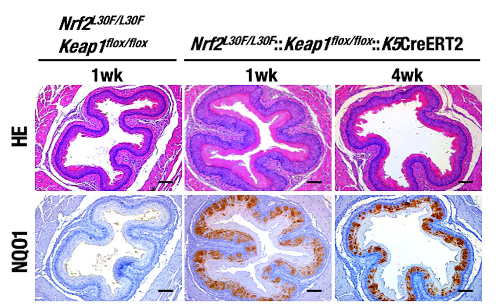 Open access visualization of Microscopy, Photo, H&E Staining, NQO1 Immunostaining, Esophagus