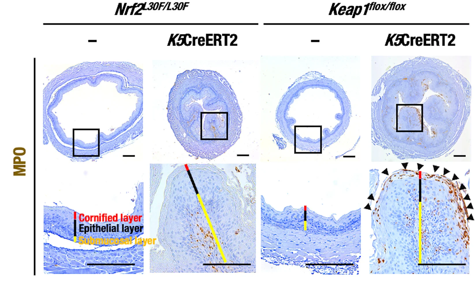 Open access visualization of Microscopy, MPO Immunostaining, Esophagus, Nrf2L30F/L30F Mice, Nrf2L30F/L30F::K5CreERT2 Mice