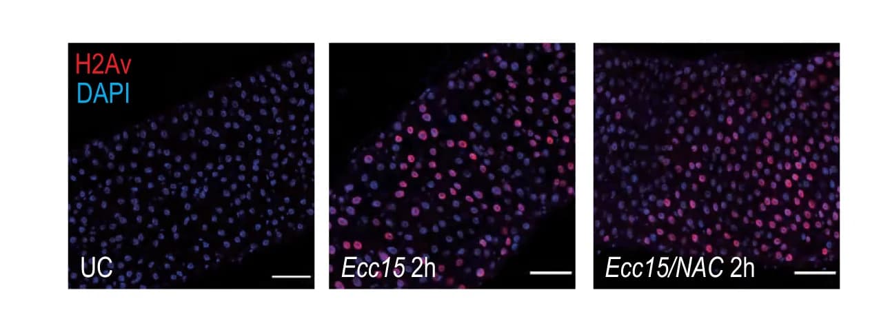 Open access visualization of Microscopy, Tissue Damage, H2Av Staining, Ecc15 Infection, NAC