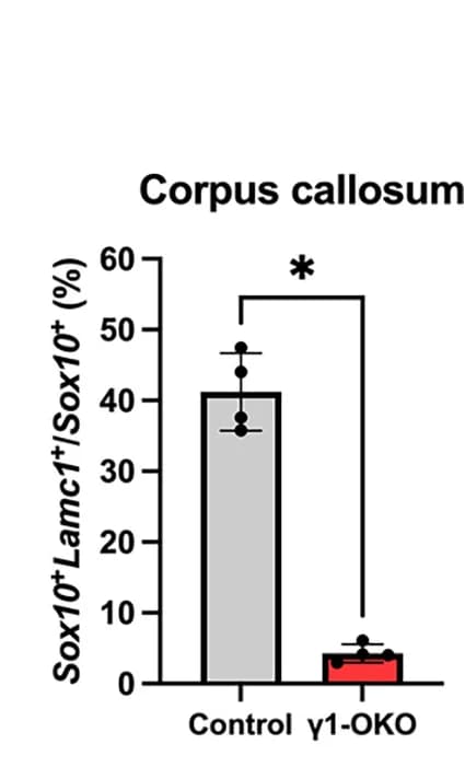 Open access visualization of Bar Plot, Error Bars, Sox10+Lamc1+ Cells, Sox10+ Cells, Corpus Callosum