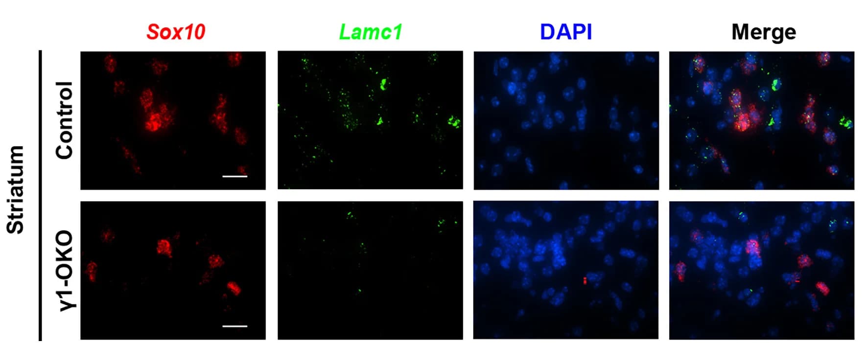 Open access visualization of Microscopy, Sox10+Lamc1+ Cells, Sox10+ Cells, Striatum, 1-OKO Mice