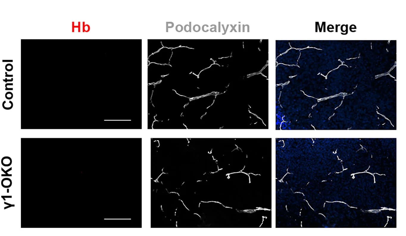 Open access visualization of Microscopy, Hemoglobin Leakage, Control Brains, γ1-OKO Brains, P1