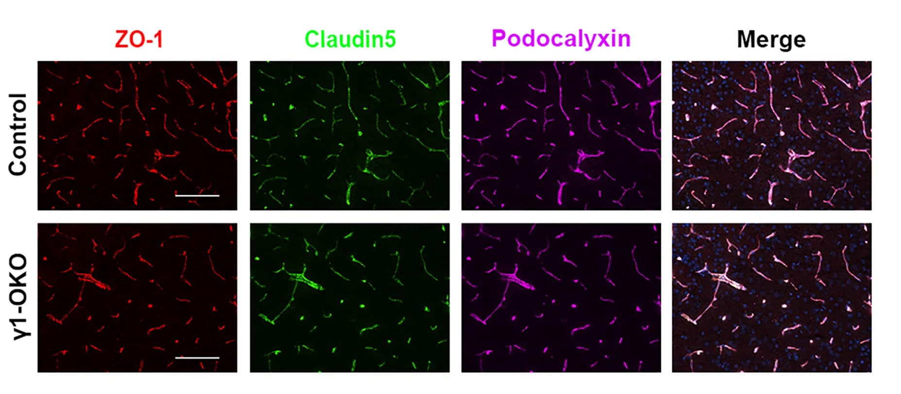 Open access visualization of Microscopy, ZO-1, Claudin-5, Podocalyxin, Vascular Marker