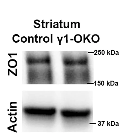 Open access visualization of Gel, Western Blotting, ZO1, Claudin-5, Cortex