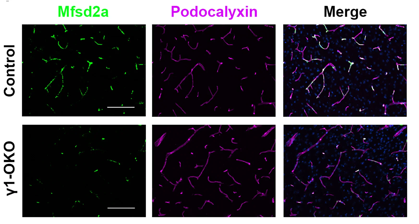 Open access visualization of Microscopy, Mfsd2a, Podocalyxin, Vascular Marker, Control Brains