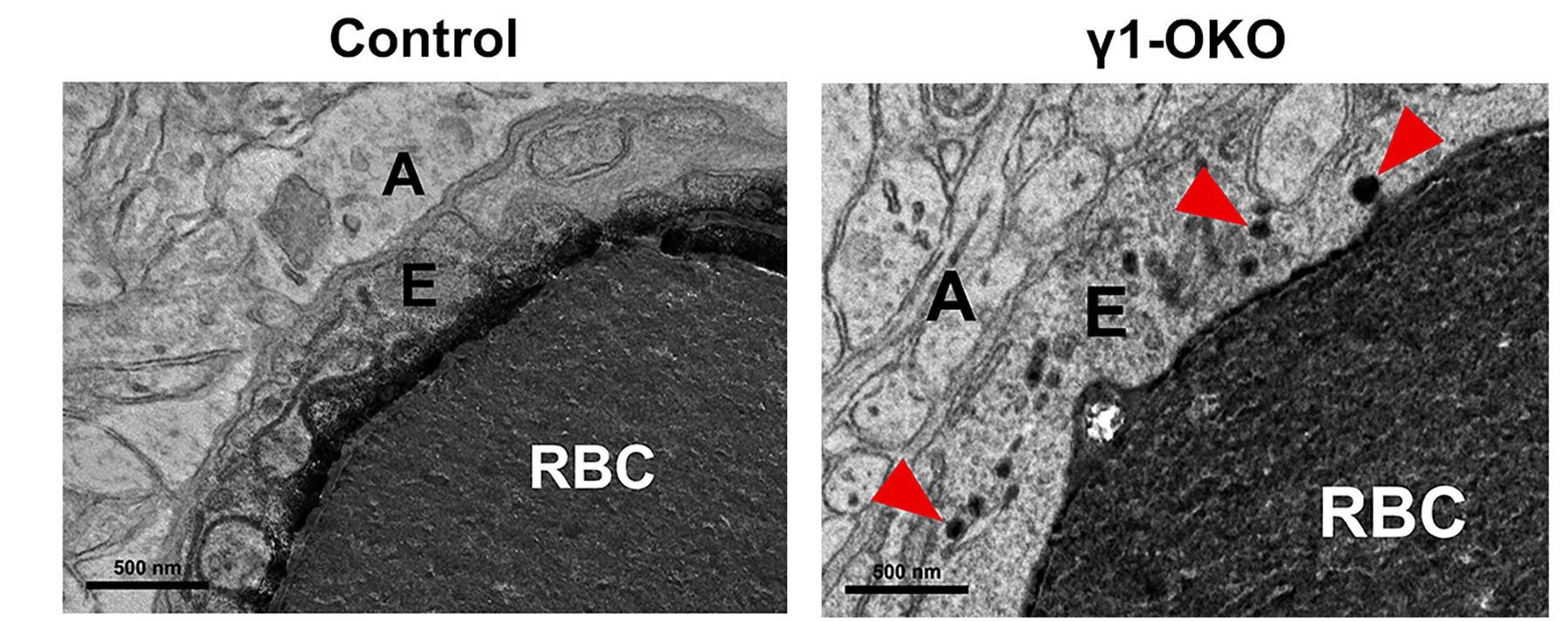 Open access visualization of Microscopy, TEM Images, Transcellular Transport, 1-OKO Mice, Transcytotic Vesicles