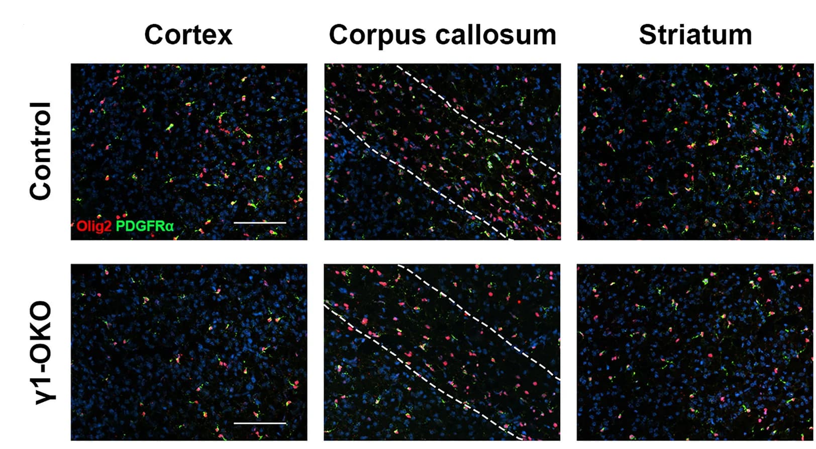 Open access visualization of Microscopy, Olig2, PDGFRalpha, Cortex, Corpus Callosum