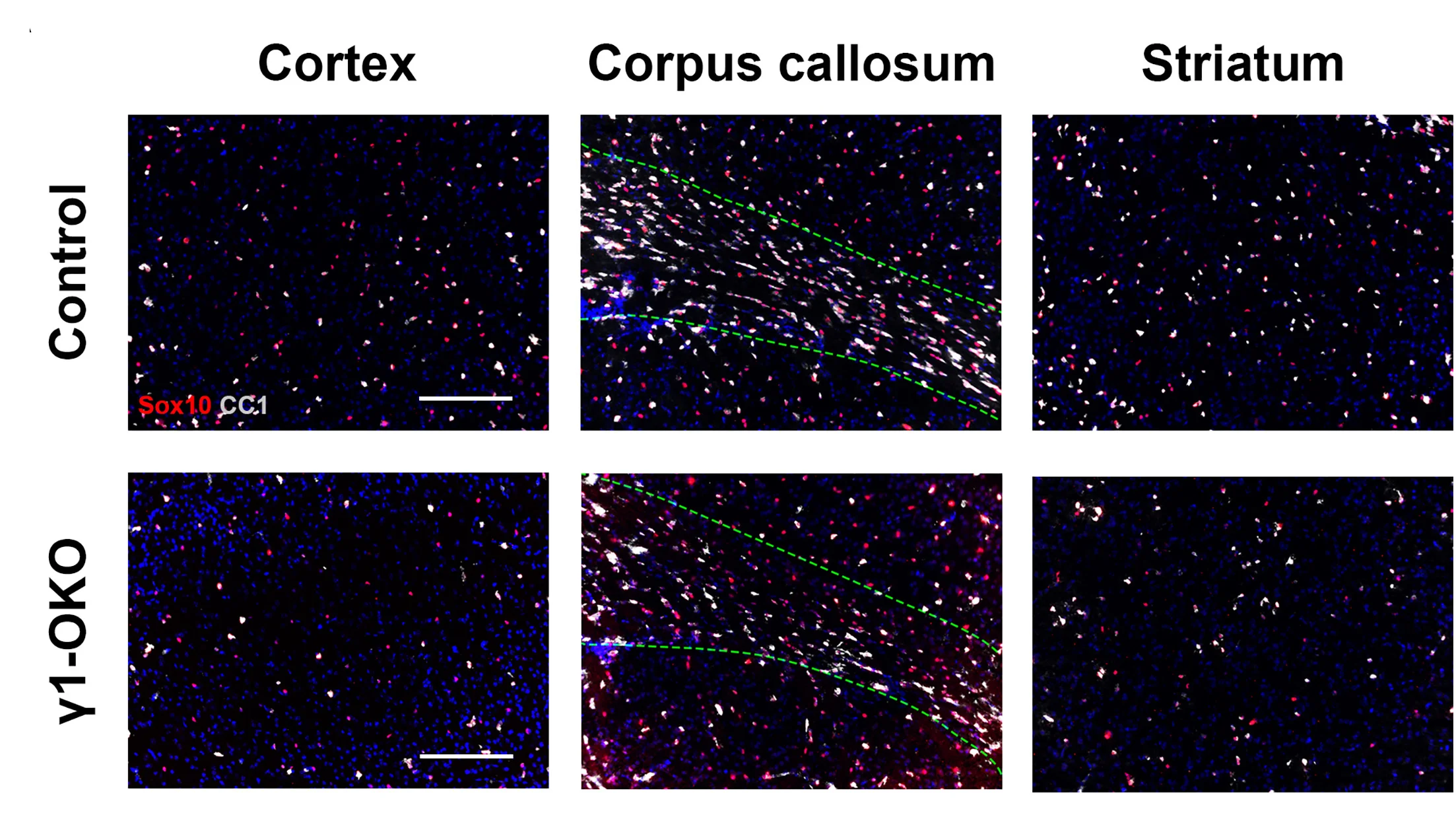 Open access visualization of Microscopy, Sox10, CC1, Cortex, Corpus Callosum