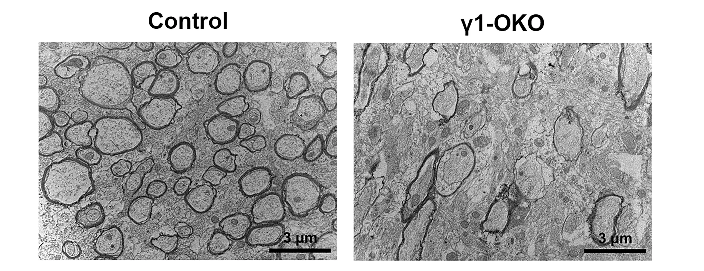 Open access visualization of Microscopy, TEM Images, Callosal Myelinated Fibers, Corpus Callosum, Control Mice