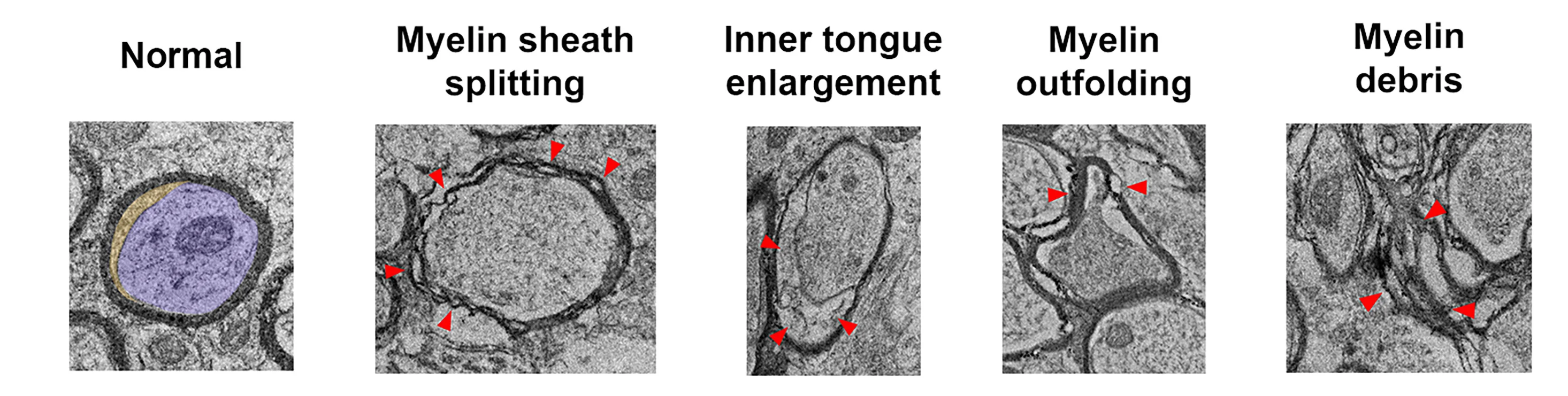 Open access visualization of Microscopy, TEM Images, Myelin Sheaths, Morphology