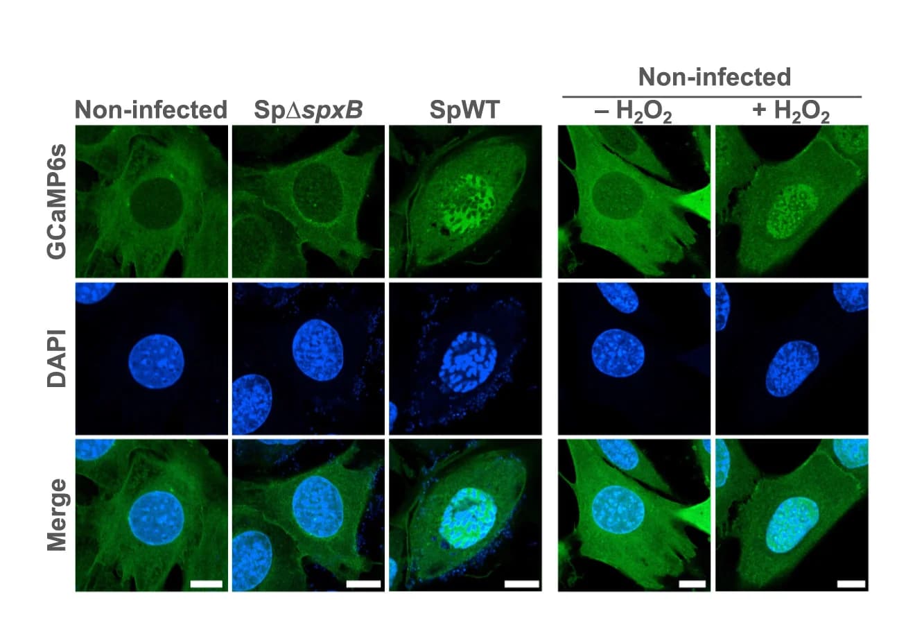 Open access visualization of Microscopy, MEFs, GCaMP6s, SpWT, SpΔspxB