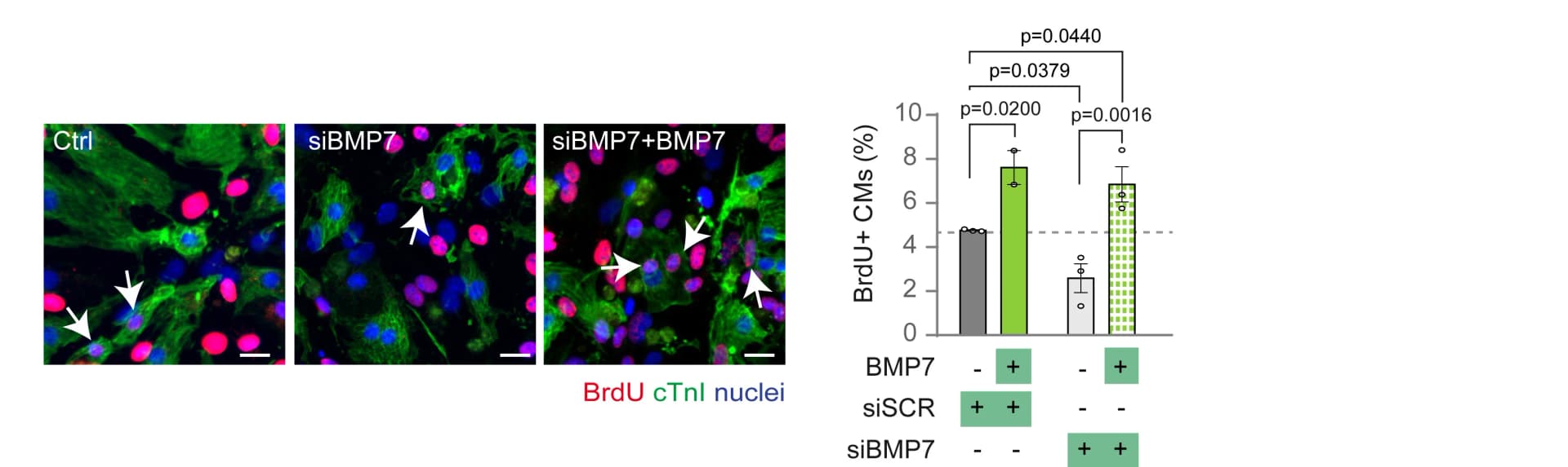 Open access visualization of Bar Plot, Error Bars, Microscopy, Photo, Cardiomyocyte Proliferation