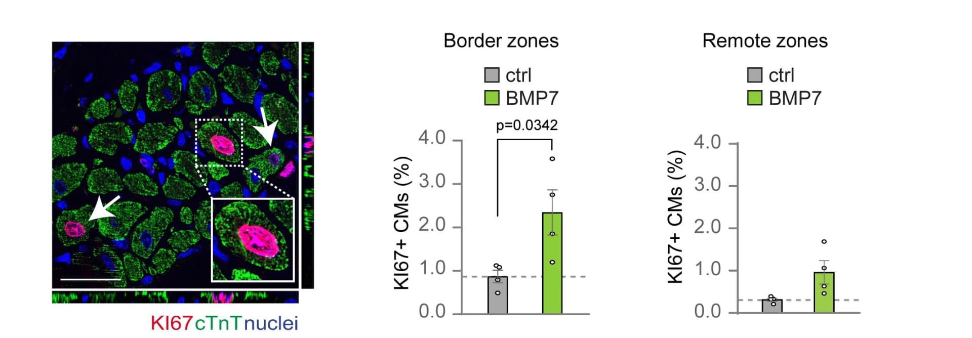 Open access visualization of Microscopy, Bar Plot, Error Bars, In Vivo Evaluation, Cardiomyocyte Proliferation