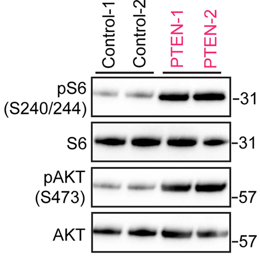 Open access visualization of Gel, Immunoblotting, mTORC1, pS6, mTORC2