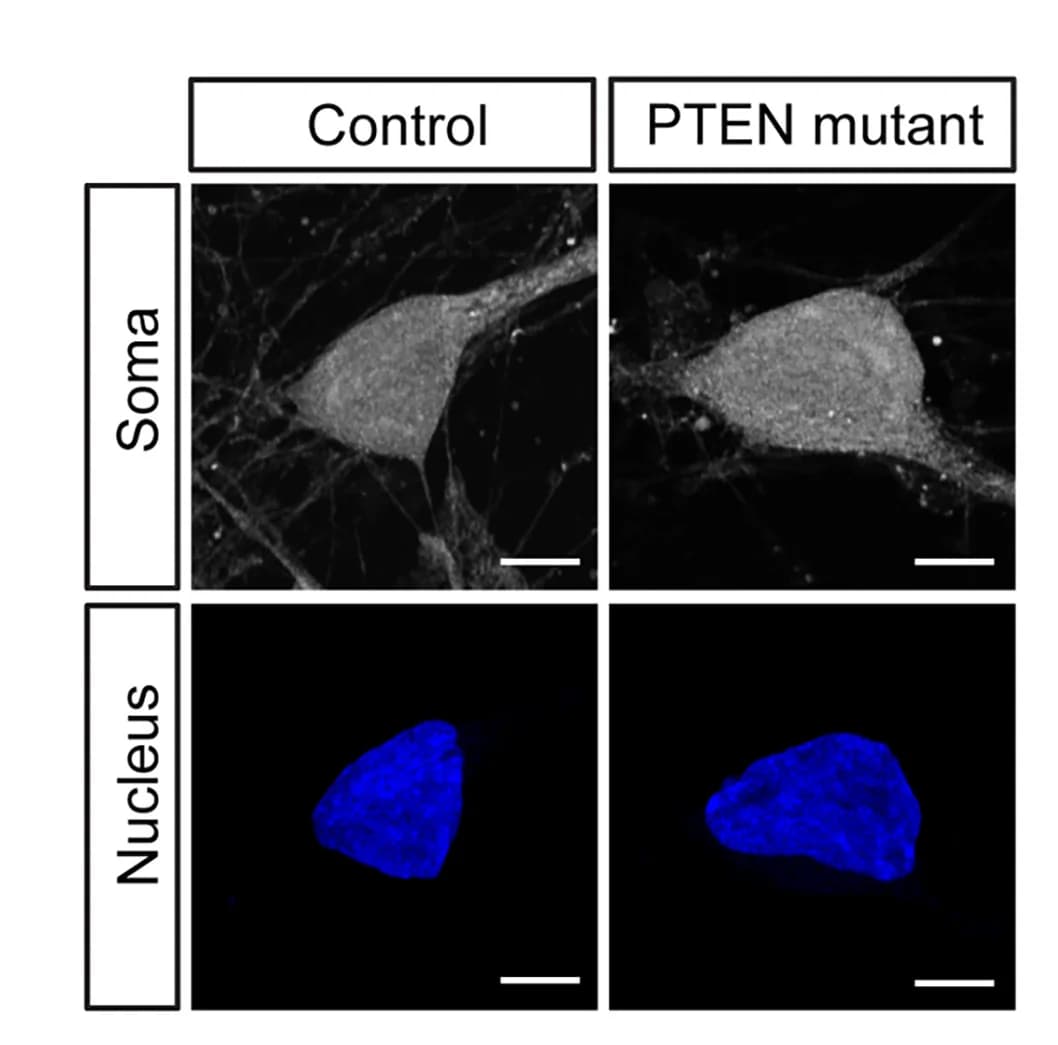 Open access visualization of Microscopy, PTEN Mutant Neurons, Soma Size, Nucleus Size, Scale Bar