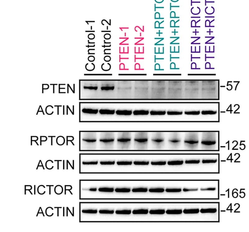 Open access visualization of Gel, Immunoblotting Analysis, PTEN, RPTOR, RICTOR