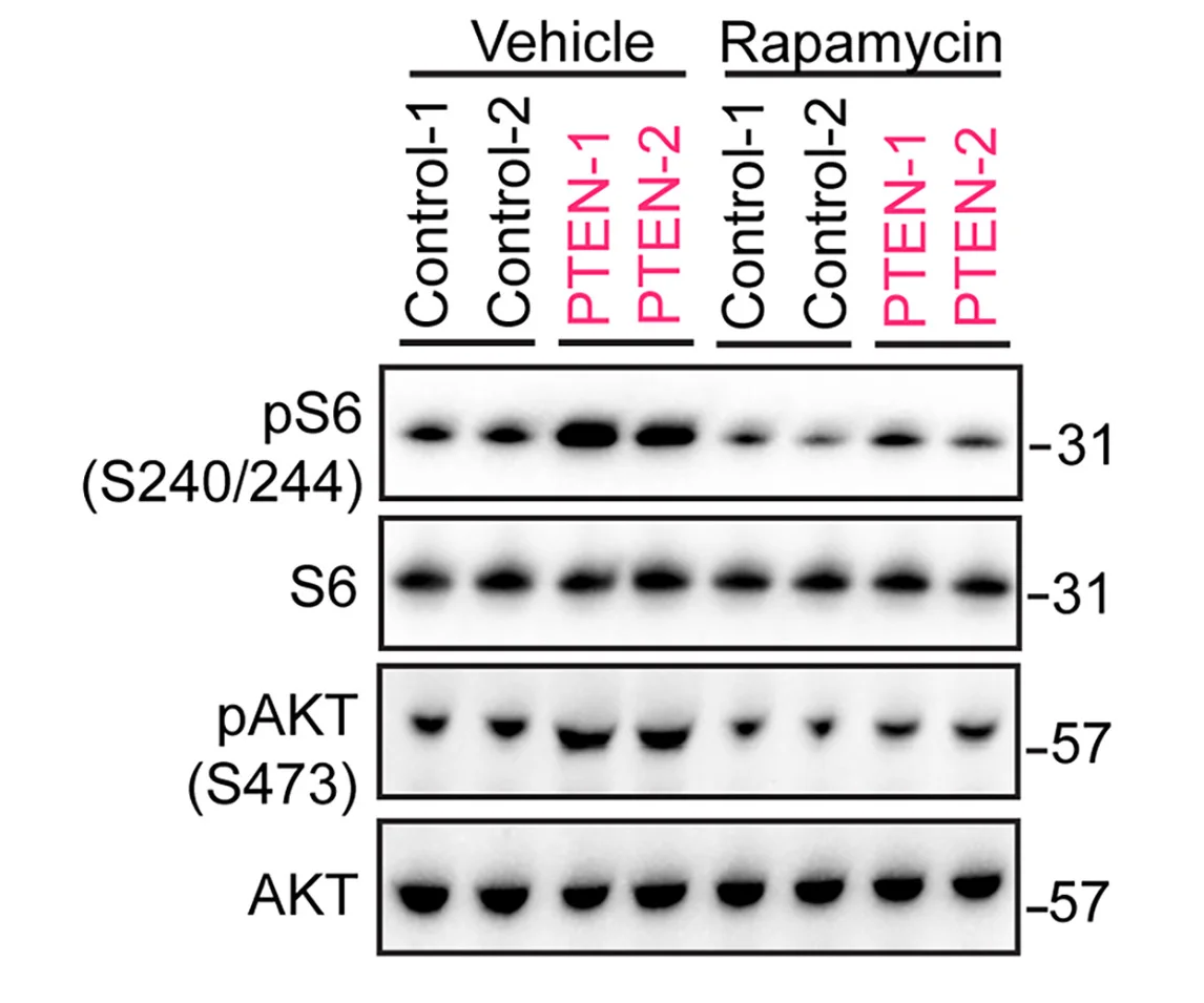 Open access visualization of Gel, Immunoblotting, Rapamycin, mTORC1, mTORC2