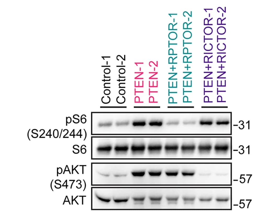 Open access visualization of Gel, Immunoblotting Analysis, PTEN, RPTOR, RICTOR