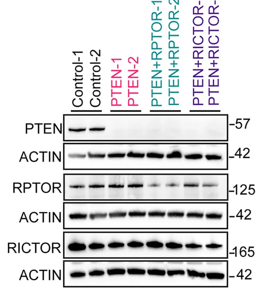Open access visualization of Gel, Immunoblotting Analysis, Protein Levels, PTEN, RPTOR