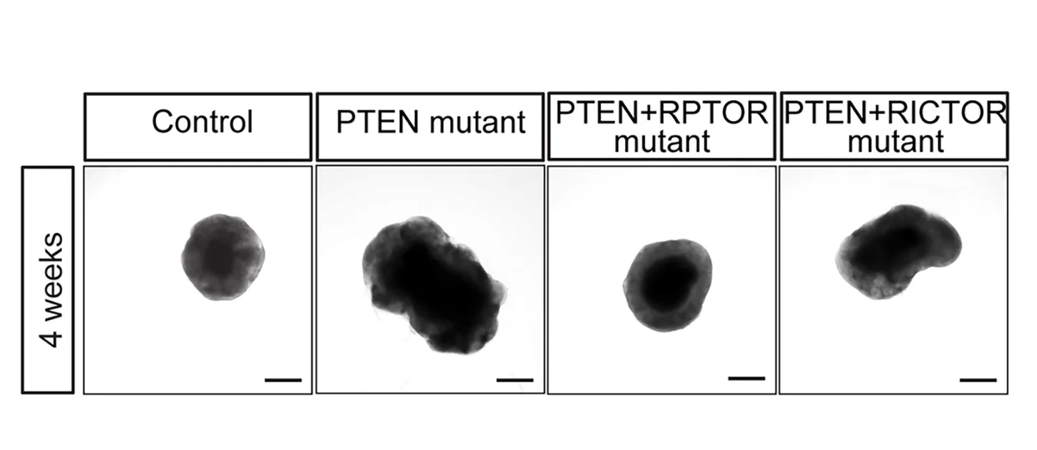 Open access visualization of Microscopy, Representative Images, Quantification, Cortical Organoids, PTEN Mutant
