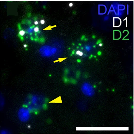 Open access visualization of Microscopy, Photomicrographs, Wild-Type Mice, D2receptor mRNA, CnF