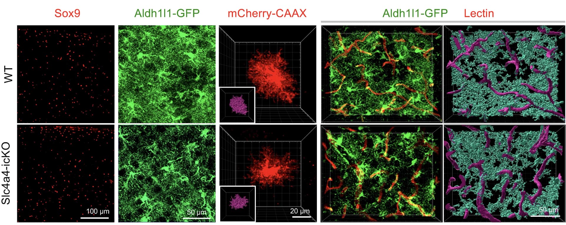 Open access visualization of Microscopy, Immunofluorescence, Astrocyte Markers, Sox9, Aldh1l1-GFP