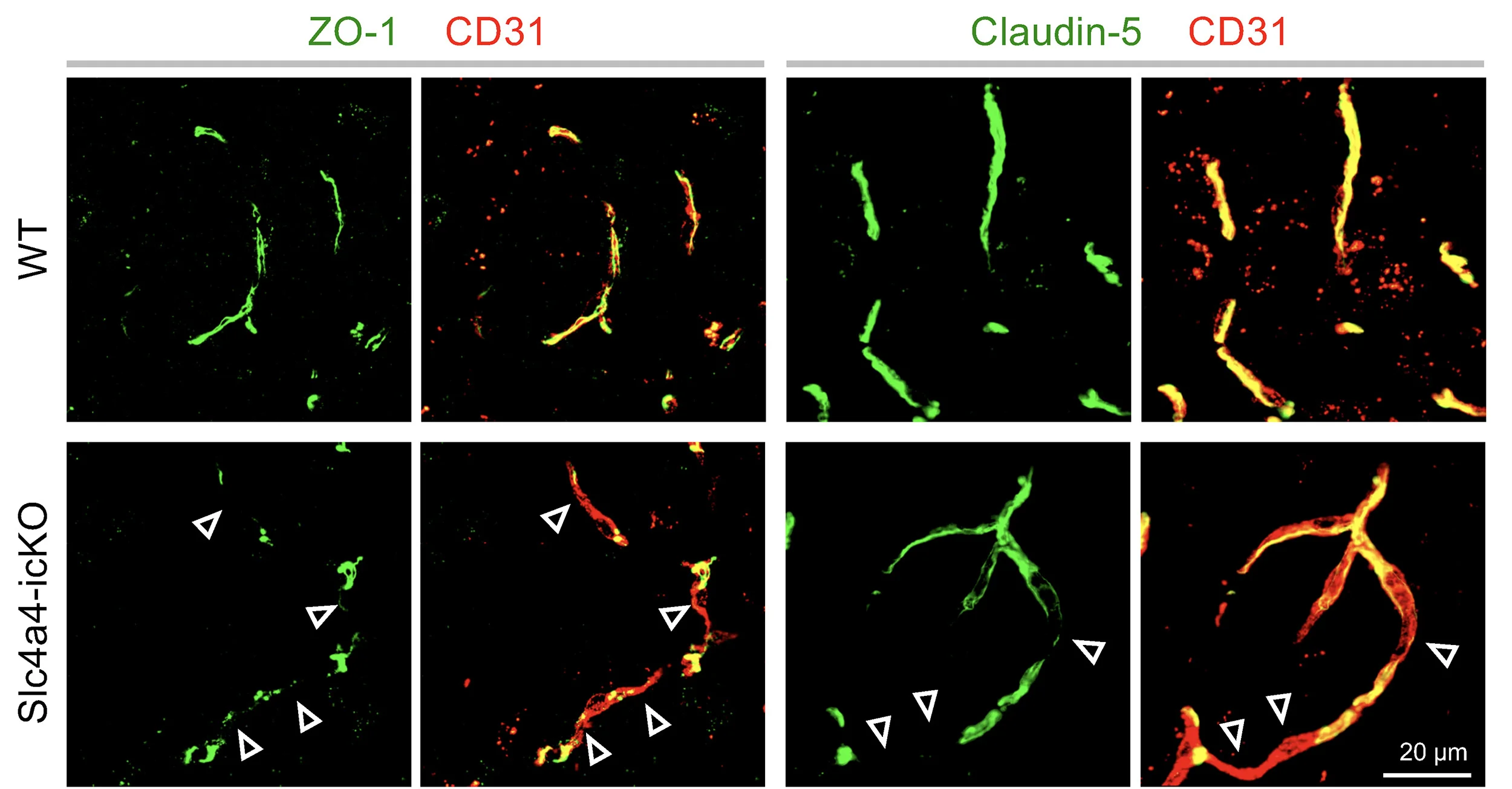Open access visualization of Microscopy, Immunofluorescence Staining, Tight-Junction Markers, ZO-1, Claudin-5