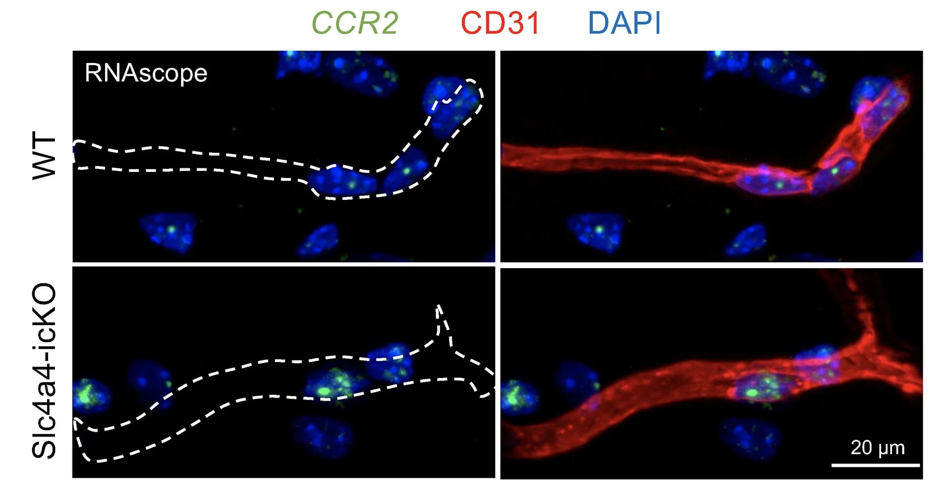 Open access visualization of Microscopy, Endothelial CCR2 mRNA Expression, RNA Scope, CD31 Staining, CCR2+ Puncta
