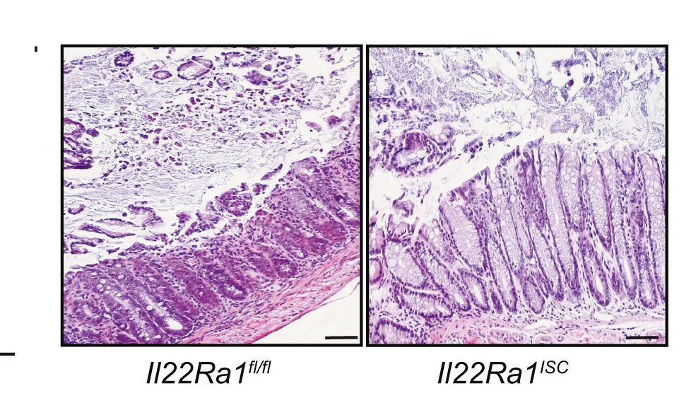 Open access visualization of Microscopy, H&E Staining, Distal Colon Tissue, DSS Treatment, Il22Ra1fl/fl