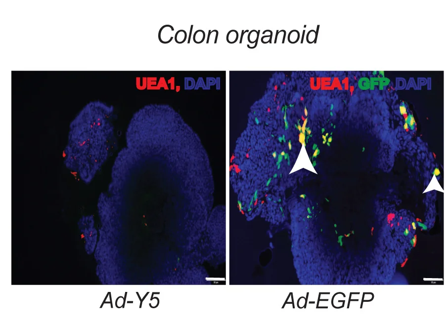 Open access visualization of Microscopy, Immunofluorescence, GFP, UEA I, DAPI