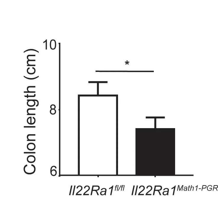 Open access visualization of Bar Plot, Error Bars, Colon Length, Distal Colon, DSS